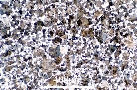 Image result for bulat steel micrograph
