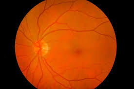 Nervous tissue, present in both the cns and pns, contains two basic types of cells: Ultra Thin Nervous Tissue For Treating Eye Problems Ibsa Foundation
