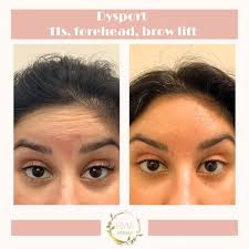 Mallorie Dammeyer, APRN