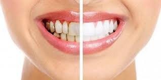 My theory is that the different brushes are better at different parts of the teeth, so alternating them helps me brush the teeth more thoroughly. Teeth Stain Causes Foods Drinks Medications And Bad Habits Dentist In Santa Rosa