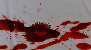 Ese día, michael estaba filmando el video blood on the dance floor. 67 Blood Gifs Gif Abyss