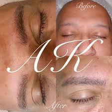 There's no better way to describe the perfectly shaped and beautifully balanced results that in fact, as you can see in this before and after, it restores the look of real eyebrows on the face and helps to regain the confidence so many have been. Microblading For Men Annette Kemp