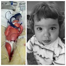 Our little NICU graduate just turned two! We will always be so grateful to  the staff at Presbyterian for taking such good care of our Adam Konnor! ❤