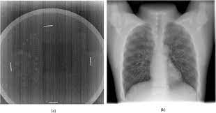 Recommended for applications requiring moderate energy resolution and count rate, where cost is most important. Survey Of Chest Radiography Systems Any Link Between Contrast Detail Measurements And Visual Grading Analysis Sciencedirect