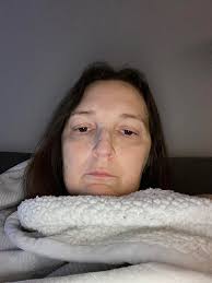 Hi everyone, Just want to give you a update. I am improving more. Without  getting too carried away. I was up the hospital today and was told  everything is healing up, so