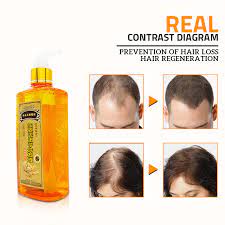 Check out the satinique anti dandruff shampoo from the satinique product collection in our product catalog. 300 Ml Chinese Medicines Professional Ginger Hair Growth Shampoo Against Hair Loss Anti Dandruff Hair Care Black Hair Shampoo Shampoos Aliexpress