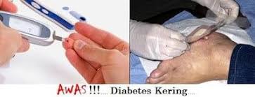 Kebiasaanya jika seseorang itu menghidap penyakit kencing manis tahap 1, masalah yang ada pada mereka ialah tubuh tidak dapat menghasilkan insulin, lebih tepat organ pankreas. Cara Mengatasi Penyakit Kencing Manis Semasa Hamil