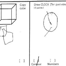 Moca scores range between 0 and 30. The Patient S Cube Copy And Clock Drawing On The Montreal Cognitive Download Scientific Diagram