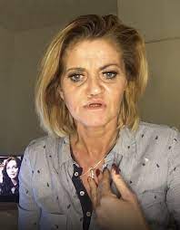 The former eastenders and hollyoaks star says she. Danniella Westbrook Reveals She S Had The First Of Four Surgeries To Repair Rotting Face Damaged By Drugs