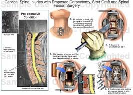 Pin Op Medical Transcription