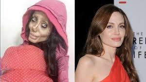 Sahar tabar claims to have gone under the knife 50 times, in a bid to look like angelina joliecredit: Kabar Terbaru Sahar Tabar Fans Berat Angelina Jolie Yang Lakukan Operasi Plastik Sebanyak 50 Kali Surya