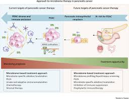 Pancreatic cancer often has a poor prognosis, even when diagnosed early. Harnessing The Microbiome For Pancreatic Cancer Immunotherapy Trends In Cancer