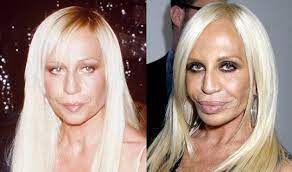 The media also said that because of her bad appearance, her career becomes downward. The Worst Celeb Plastic Surgeries Of All Time Rantlifestyle Bad Celebrity Plastic Surgery Celebrity Plastic Surgery Plastic Surgery Gone Wrong