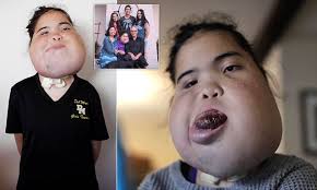 California teenager not expected to live set to graduate