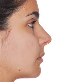 Digital platform for planning facial asymmetry orthodontic-surgical  treatment preparation