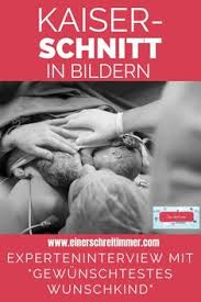 Bei einer natürlichen geburt entscheidet das baby, wann es soweit ist. 900 Geburt Ideen In 2021 Geburt Kaiserschnitt Geburt Vorbereitung