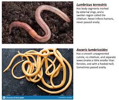 I am wondering what kind of worm is that. Do Humans Carry Earthworm Like Worms In The Body As I Saw One In The Toilet Quora