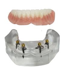 We did not find results for: Dental Implants Google Landing Insight Dental And Implants Oklahoma City Ok
