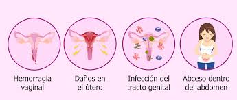 Fertilidad Despues Del Aborto Es Posible El Embarazo