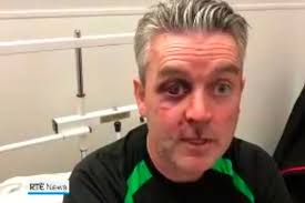 Referee Daniel Sweeney underwent gruelling five-hour surgery after savage  attack
