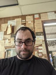 Before and after. : r/bald