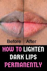How To Lighten Dark Lips Permanently 13 Natural Home Remedies Natural Pink Lips Remedies For Dark Lips Dark Lips