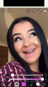 Danielle with Braces