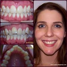 Lizzy radiates with a confident Smile!