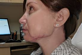 Before and After the Las Vegas Shooting: A Survivor's Story