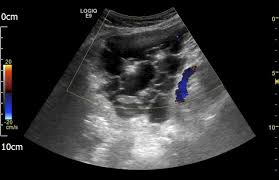 We did not find results for: View Of Photography Transillumination Techniques Multicystic Peritoneal Mesothelioma Journal Of Biocommunication
