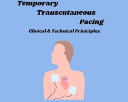 Image result for Transcutaneous Pacing