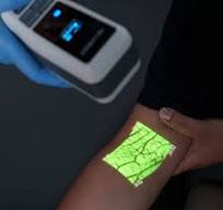 Lite 2.0 Vein Finder for Safe and Accurate Vein Detection