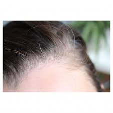 Par rapport à d'autres hennés, son. La Coloration Vegetale Et Les Cheveux Blancs Coloration Naturelle Cheveux Cheveux Blancs Coloration Naturelle Cheveux Blancs