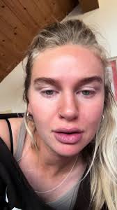 Ist halt auch schnupfenzeit 🥺