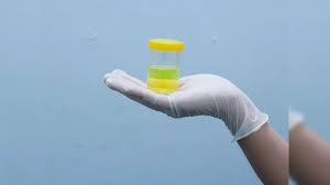 Best Foods To Reduce Uric Acid,पेशाब में झाग या जलन, 5 लक्षण बताते हैं शरीर  में भर गया Uric Acid, 10 उपाय करेंगे मदद - 5 symptoms of high uric acid  level