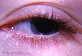 Image result for Blepharis involucrata