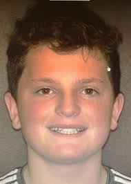 Congratulations to Jacob Johnson who just finished with orthodontic  treatment with the fabulous Dr. Moravec and His Staff. Jacob is the son of  our hygienist Sarah Johnson. We are so excited to