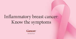 Inflammatory breast cancer (ibc) is a rare and aggressive form of breast cancer, characterized by diffuse dermatologic erythema and edema (peau d'orange). Inflammatory Breast Cancer Symptoms What To Know Md Anderson Cancer Center