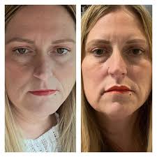 Elissa Kalivas Berkowitz (@np_elissa) • Instagram photos and videos