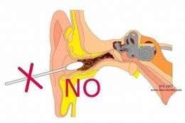 Resultado de imagen para tapon de cerumen sintomas
