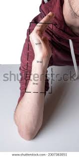 Image result for Ulnar Gutter Splint