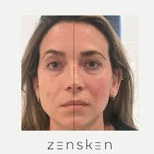 Discover the exceptional...