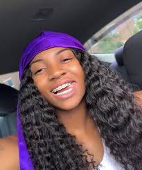 Black And Purple Braces Color Pin By Dira On Durag Draggin Braces Girls Curly Hair Women Brace Face