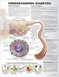 Understanding Diabetes Anatomical Chart 9781469894928