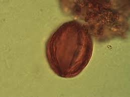 Image result for Gilbertiodendron dewevrei