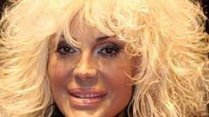Rettore was one of the most famous female italian singer in the '80s. Donatella Rettore E Il Tumore Abbiate Cura Di Claudio Il Secolo Xix