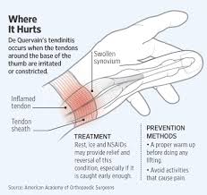 The Baby May Be Giving You Mommy Thumb Wsj
