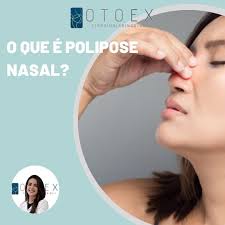 OTOEX Otorrinolaringologia