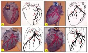 The size, number and origin of coronary arteries and its branches. The Branching Pattern Of Lca A Bifurcation B Trifurcation C Download Scientific Diagram