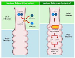 Check spelling or type a new query. Lactose Intolerance Bioninja